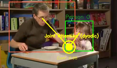 Automated gaze‑based autism screening pipeline