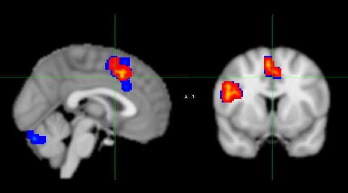 University of Alberta